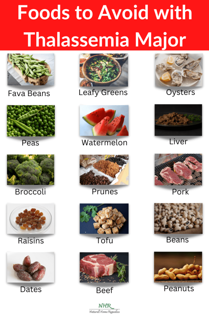list of foods that should be avoided with thalassemia major